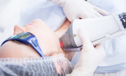 準分子激光 準分子激光