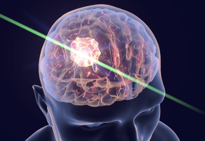 術中成像用藍寶石 術中成像用藍寶石